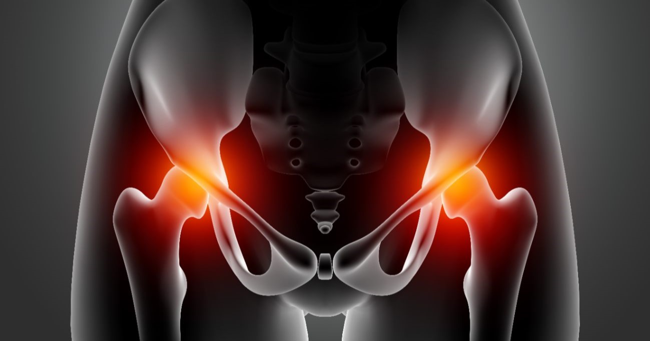 Hip Pain